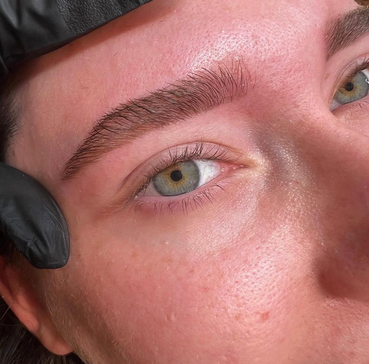 מיקרובליידינג